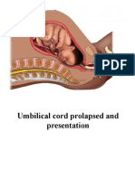 Cord Prolapse