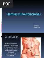 Seminario de Hernia