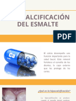 Hipocalcificación Del Esmalte