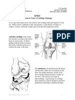 Meniscus Tears - Cartilage Damage: Knee