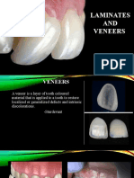 Laminates AND Veneers: Dr. Sakshi Rawal Department of Prosthodontics MDS II Year