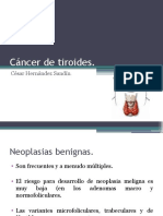 Cancer de Tiroides