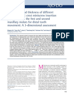 Bone Depth and Thickness of Different Infrazygomatic Crest Miniscrew Insertion Paths Between The First and Second Maxillary Molars For Distal Tooth Movement: A 3-Dimensional Assessmen