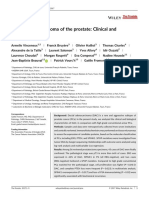 Ductal Adenocarcinoma of The Prostate: Clinical and Biological Profiles