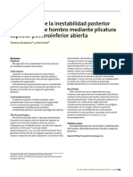 Tratamiento de La Inestabilidad Posterior Atraumática de Hombro Mediante Plicatura Capsular Posteroinferior Abierta