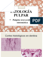 Pulpitis Reversible DX Diferencial y Pulpitis Irreversible Asintomática