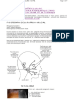 Paralisis Facial