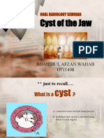 Cyst of The Jaw