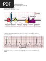 Trabajo Practico ECG - Constanza Errandonea