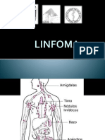 Linfoma 161212004141