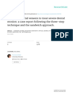 Palatal and Facial Veneers To Treat Severe Dental Erosion: A Case Report Following The Three-Step Technique and The Sandwich Approach