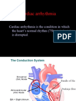 AntiArrythmtic Drug