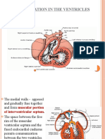 Septum Formation in The Ventricles