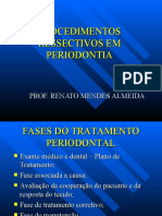 Procedimentos Ressectivos em Periodontia