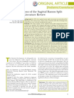 The Modifications of The Sagittal Ramus Split Osteotomy: A Literature Review