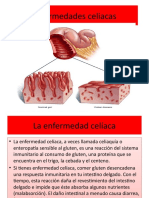 Enfermedades Celiacas