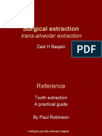 Surgical Extraction