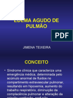 Edema Agudo de Pulmão