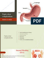 Peptic Ulcer Complications