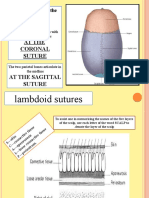 Lambdoid Sutures: at The Coronal Suture