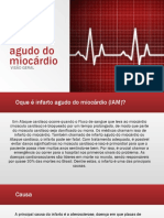 Infarto Agudo Do Miocárdio