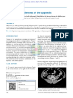 Mucinous Cystadenoma of The Appendix