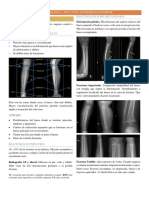 CT02 - Fracturas
