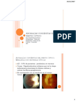 Anomalías Congénitas Del Nervio Óptico