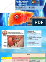 Absceso Hepático Amebiano