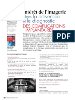 Interet de Limagerie Dans La Prevention Et Le Diagnostic Des Complications Implantaires