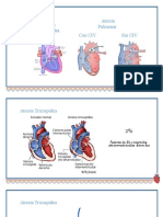 Atresia Pulmonar y Tricuspidea en Pediatría