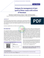 Different Techniques For Management of Pier Abutment: Reports of Three Cases With Review of Literature