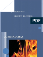 Queimaduras Choque Eletrico