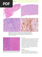 Infecciones Del Higado 2 (28-37) .En - Es