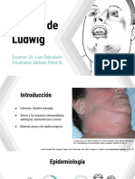 Angina de Ludwig