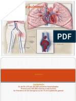 Tromboembolia Pulmonar TVP RFM Medicina Interna 2