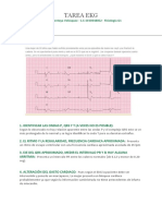 TAREA EKG - Nicolas Montoya V