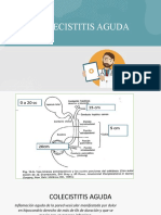 Colecistitis Aguda