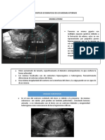 Caracteristicas Ecograficas de Los Miomas Uterinos..