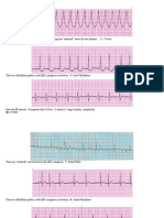 Ekg Practice