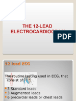 The 12-Lead Electrocardiogram