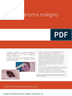 Melanoma Maligno-Expo