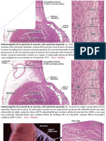 LHis Cardiovascular