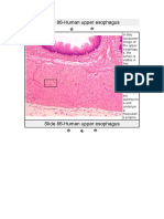 Slide 86-Human Upper Esophagus