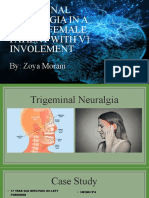 Trigeminal Neuralgia in A Young Female Patient With V1 Involement