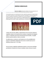 Troneras Gingivales y Oclusion