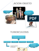 Tuberculosis