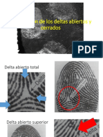 Clasificación de Los Deltas Abiertos y Cerrados