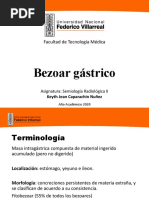 Bezoar Gastrico