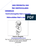 Hidrocefalia Fetal e Neonatal